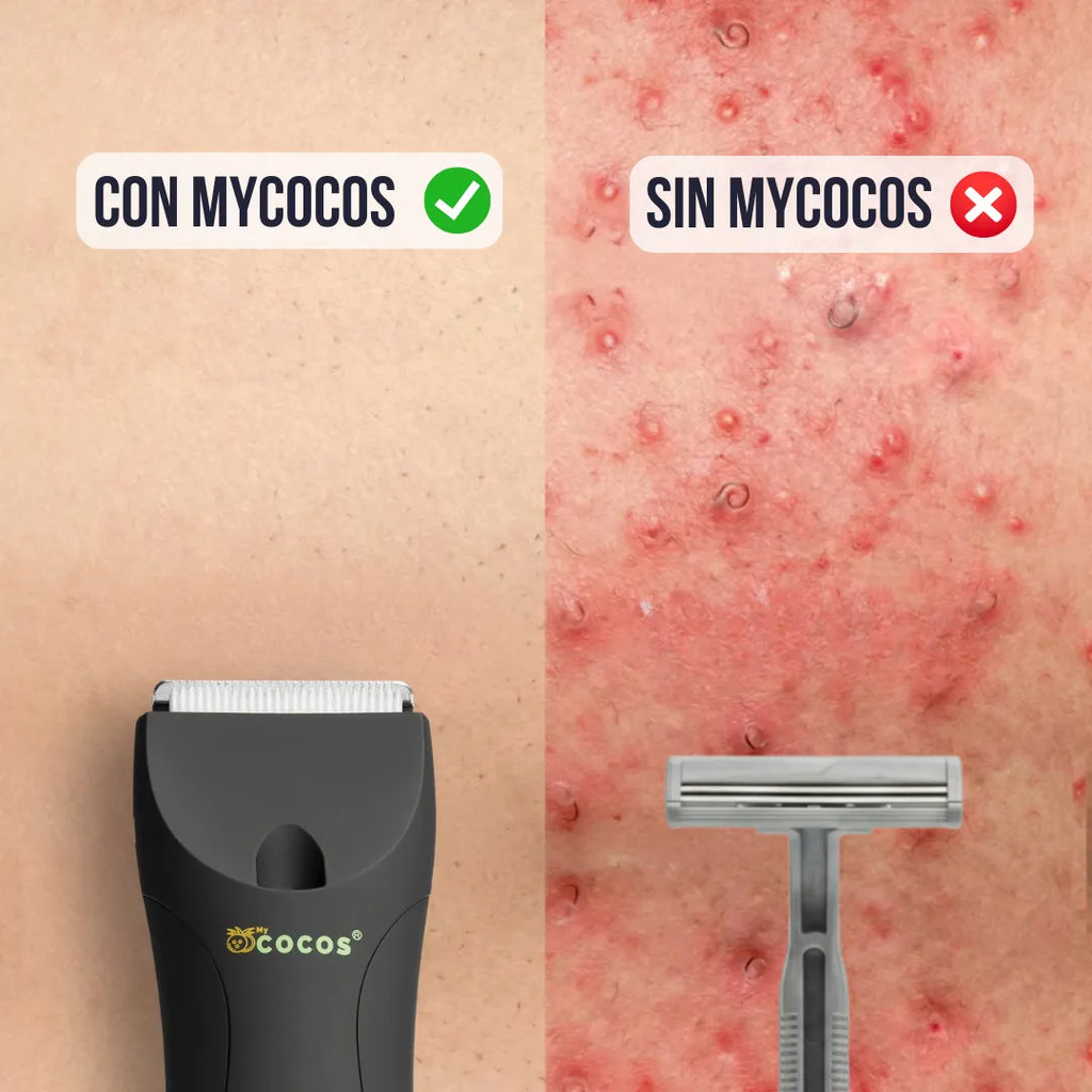 MYCOCOS® 4.0