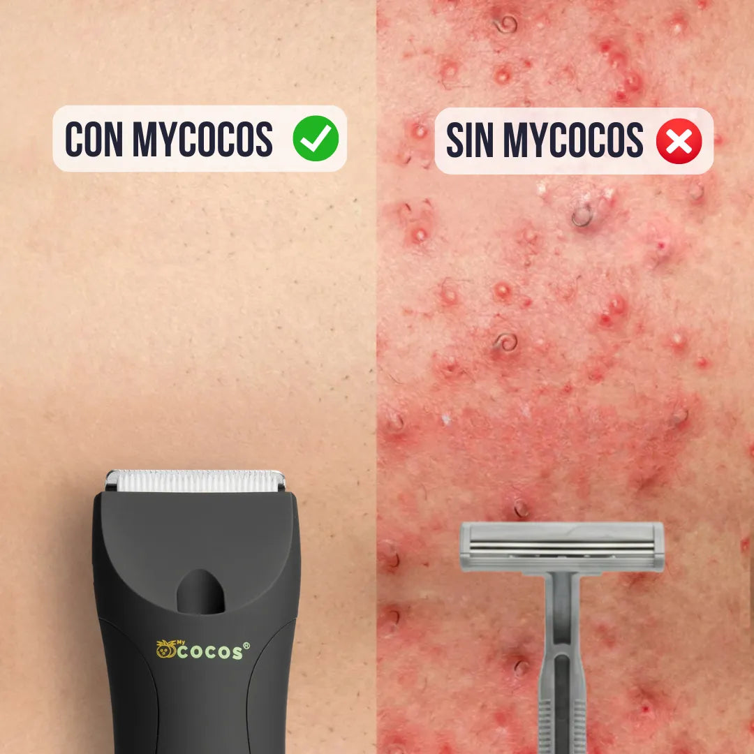 MYCOCOS® 4.0